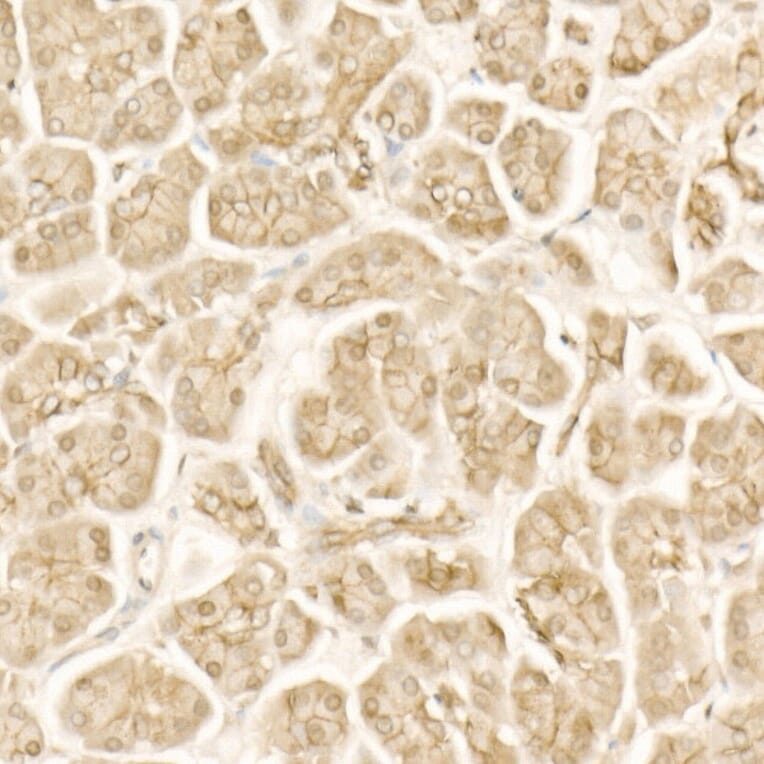 Immunohistochemistry - Anti-beta Catenin Antibody (A12611) - Antibodies.com
