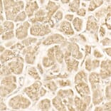 Immunohistochemistry - Anti-beta Catenin Antibody (A12611) - Antibodies.com