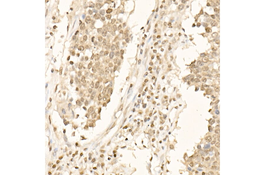 Immunohistochemistry - Anti-beta Catenin Antibody (A12611) - Antibodies.com