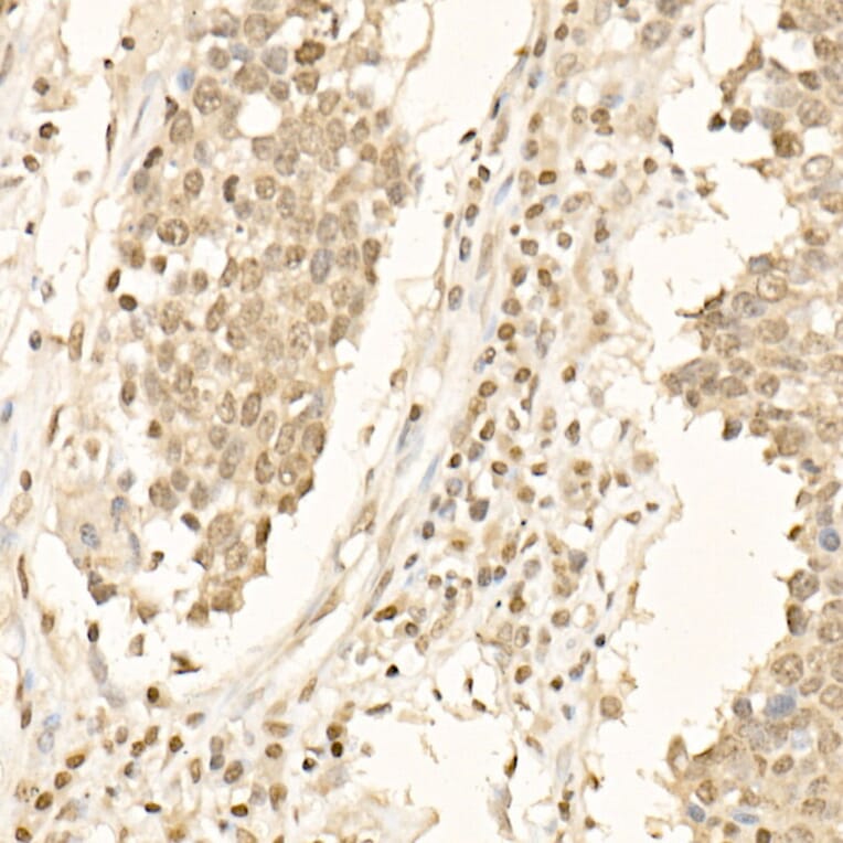 Immunohistochemistry - Anti-beta Catenin Antibody (A12611) - Antibodies.com