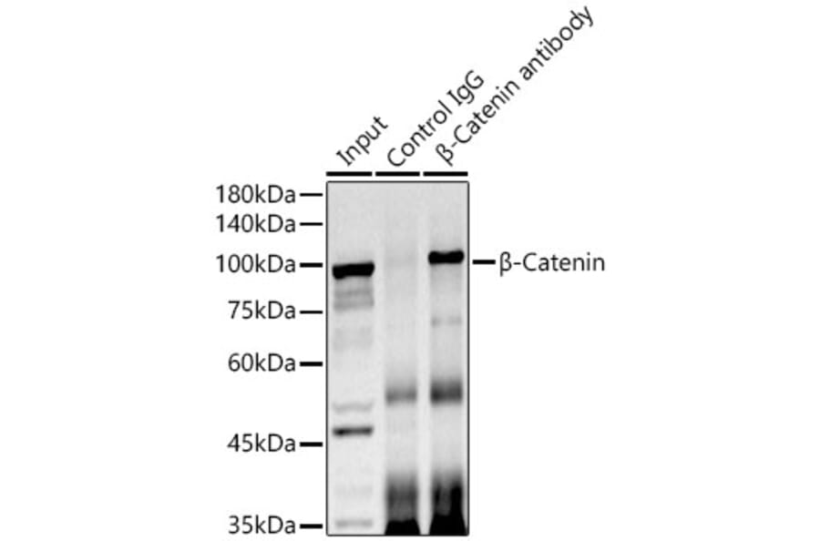 Western Blot - Anti-beta Catenin Antibody (A12611) - Antibodies.com