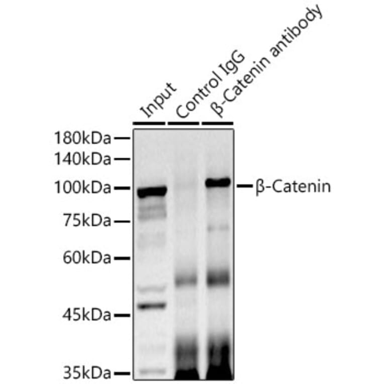 Western Blot - Anti-beta Catenin Antibody (A12611) - Antibodies.com