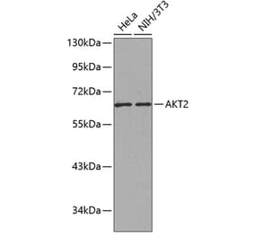 Western Blot - Anti-AKT2 Antibody (A12613) - Antibodies.com