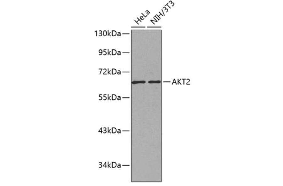 Western Blot - Anti-AKT2 Antibody (A12613) - Antibodies.com