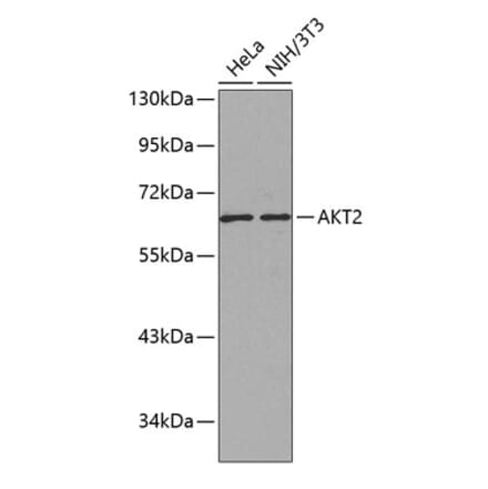 Western Blot - Anti-AKT2 Antibody (A12613) - Antibodies.com