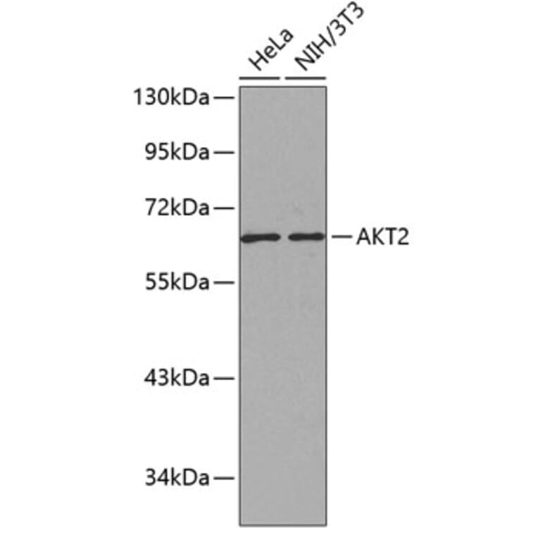 Western Blot - Anti-AKT2 Antibody (A12613) - Antibodies.com