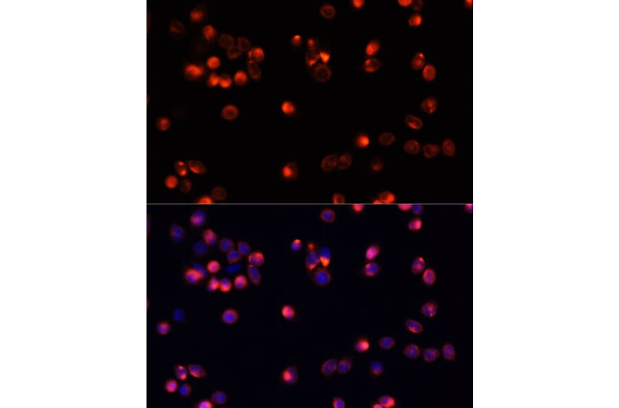 Immunofluorescence - Anti-AKT2 Antibody (A12613) - Antibodies.com