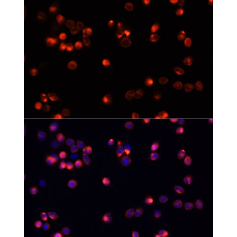 Immunofluorescence - Anti-AKT2 Antibody (A12613) - Antibodies.com