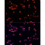 Immunofluorescence - Anti-AKT2 Antibody (A12613) - Antibodies.com