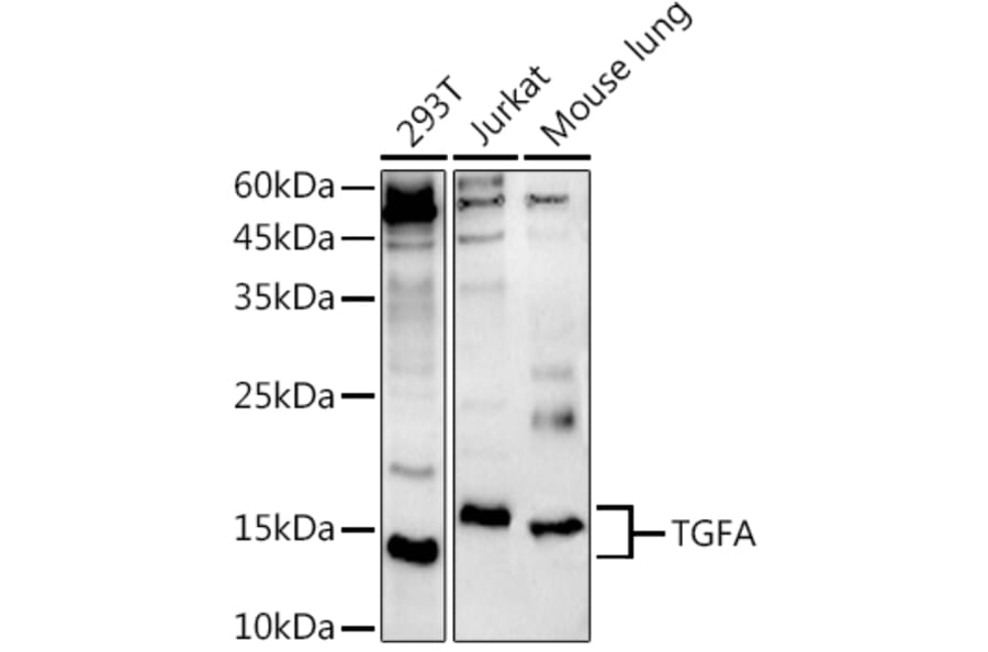 Western Blot - Anti-TGF alpha Antibody (A12614) - Antibodies.com