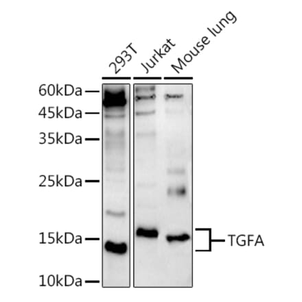 Western Blot - Anti-TGF alpha Antibody (A12614) - Antibodies.com