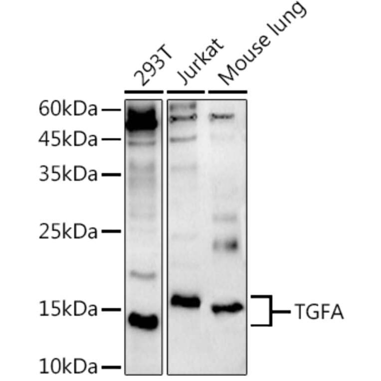 Western Blot - Anti-TGF alpha Antibody (A12614) - Antibodies.com