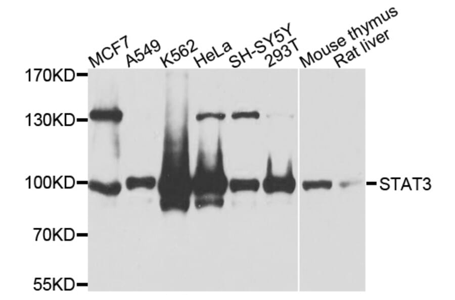 Western Blot - Anti-STAT3 Antibody (A0338) - Antibodies.com