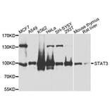 Western Blot - Anti-STAT3 Antibody (A0338) - Antibodies.com