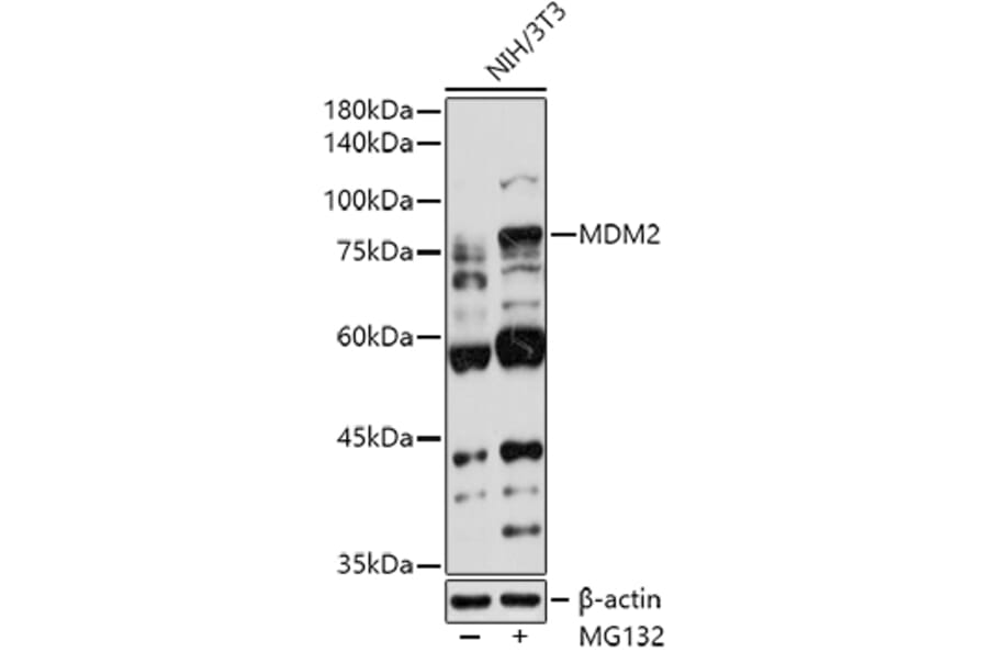 Western Blot - Anti-MDM2 Antibody (A12616) - Antibodies.com