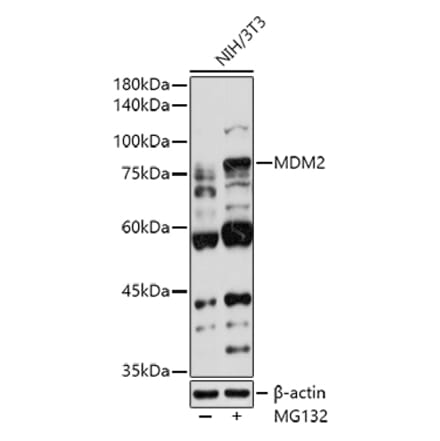 Western Blot - Anti-MDM2 Antibody (A12616) - Antibodies.com