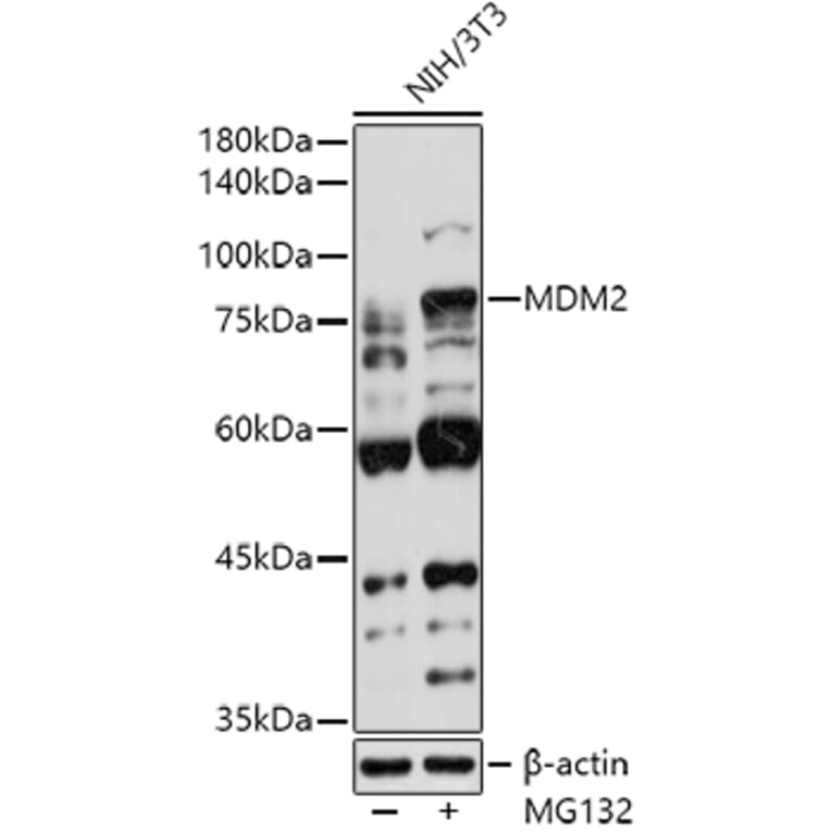 Western Blot - Anti-MDM2 Antibody (A12616) - Antibodies.com