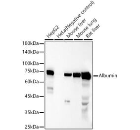 Western Blot - Anti-Albumin Antibody (A12617) - Antibodies.com