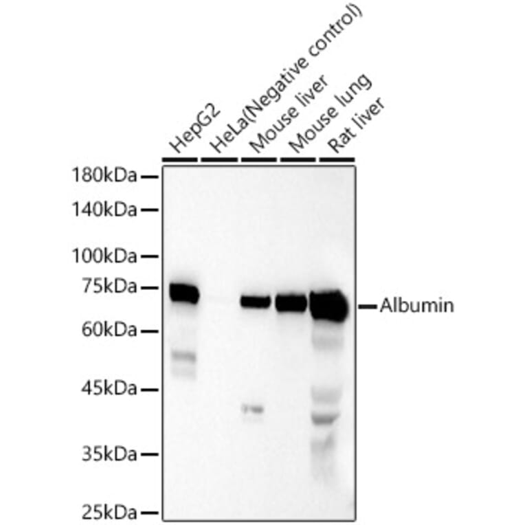 Western Blot - Anti-Albumin Antibody (A12617) - Antibodies.com