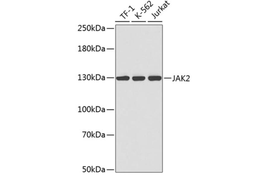 Western Blot - Anti-JAK2 Antibody (A0360) - Antibodies.com