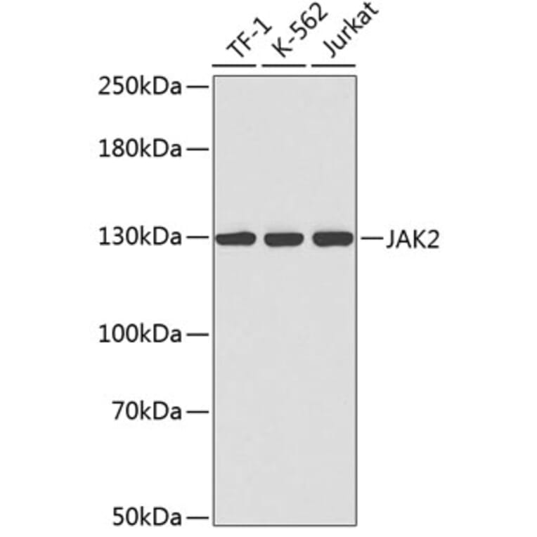 Western Blot - Anti-JAK2 Antibody (A0360) - Antibodies.com