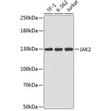 Western Blot - Anti-JAK2 Antibody (A0360) - Antibodies.com