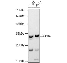 Western Blot - Anti-Cdk4 Antibody (A12620) - Antibodies.com