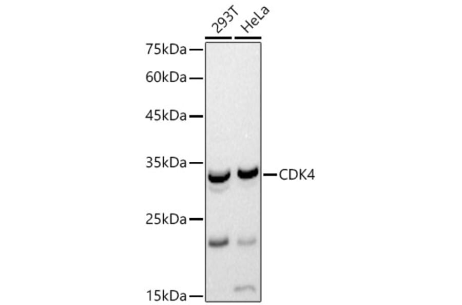 Western Blot - Anti-Cdk4 Antibody (A12620) - Antibodies.com