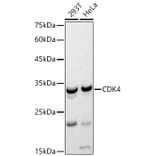 Western Blot - Anti-Cdk4 Antibody (A12620) - Antibodies.com