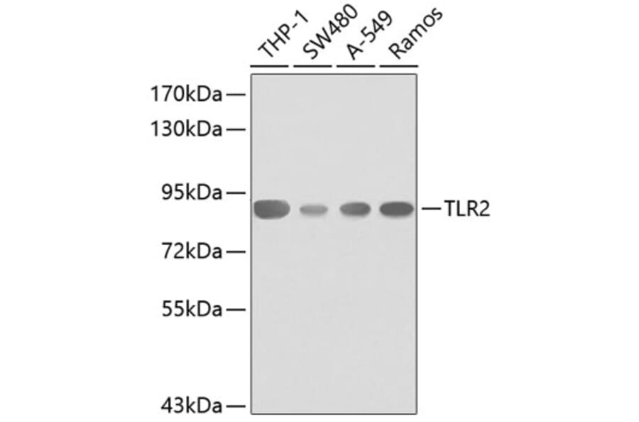 Western Blot - Anti-TLR2 Antibody (A0367) - Antibodies.com