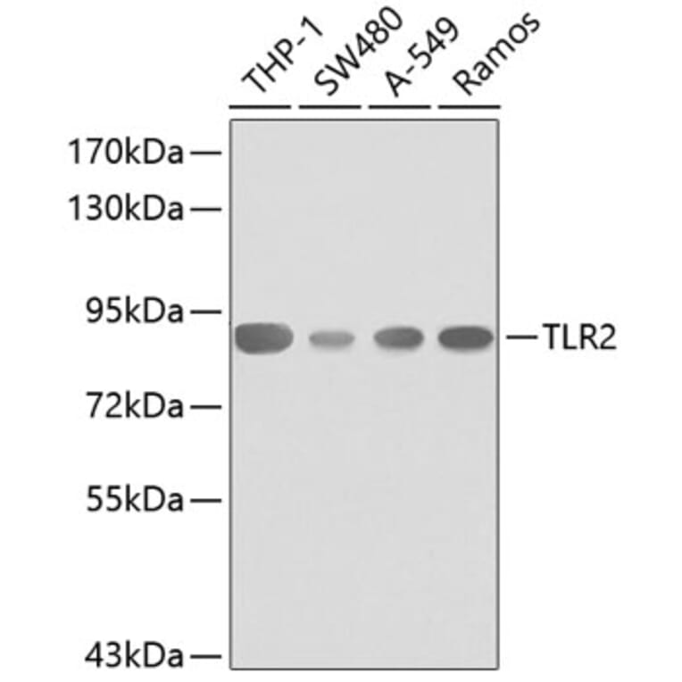 Western Blot - Anti-TLR2 Antibody (A0367) - Antibodies.com