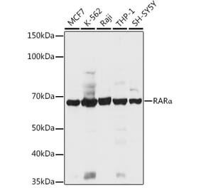 Western Blot - Anti-Retinoic Acid Receptor alpha Antibody (A12622) - Antibodies.com