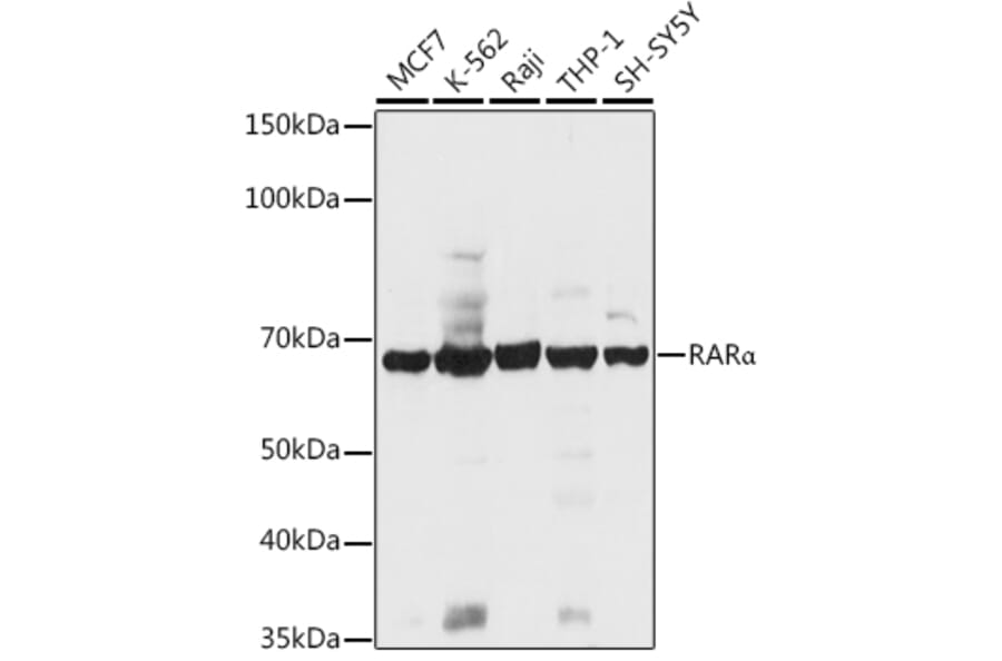 Western Blot - Anti-Retinoic Acid Receptor alpha Antibody (A12622) - Antibodies.com