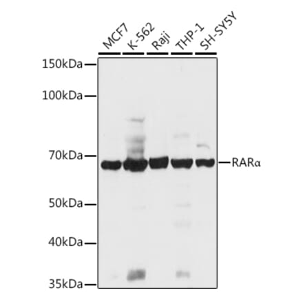 Western Blot - Anti-Retinoic Acid Receptor alpha Antibody (A12622) - Antibodies.com