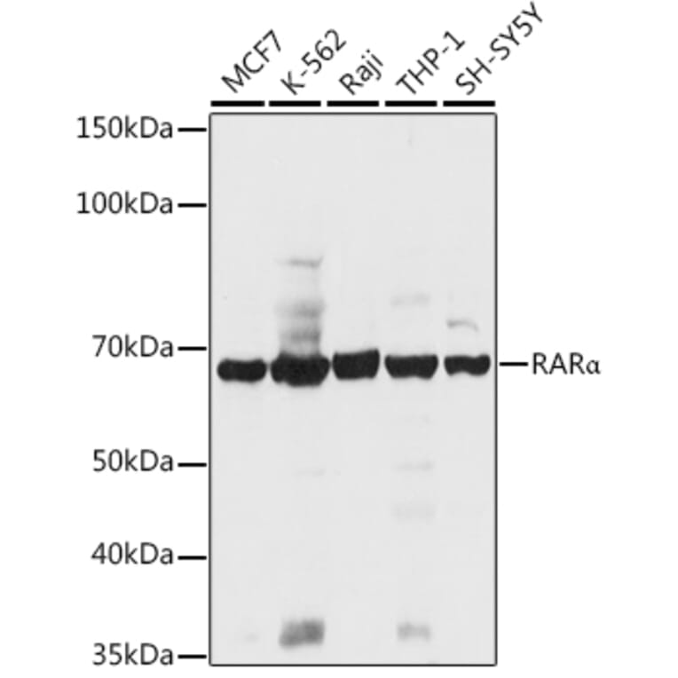 Western Blot - Anti-Retinoic Acid Receptor alpha Antibody (A12622) - Antibodies.com