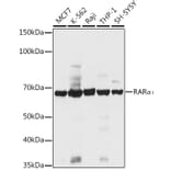 Western Blot - Anti-Retinoic Acid Receptor alpha Antibody (A12622) - Antibodies.com