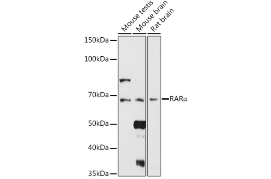 Western Blot - Anti-Retinoic Acid Receptor alpha Antibody (A12622) - Antibodies.com