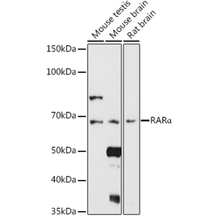 Western Blot - Anti-Retinoic Acid Receptor alpha Antibody (A12622) - Antibodies.com