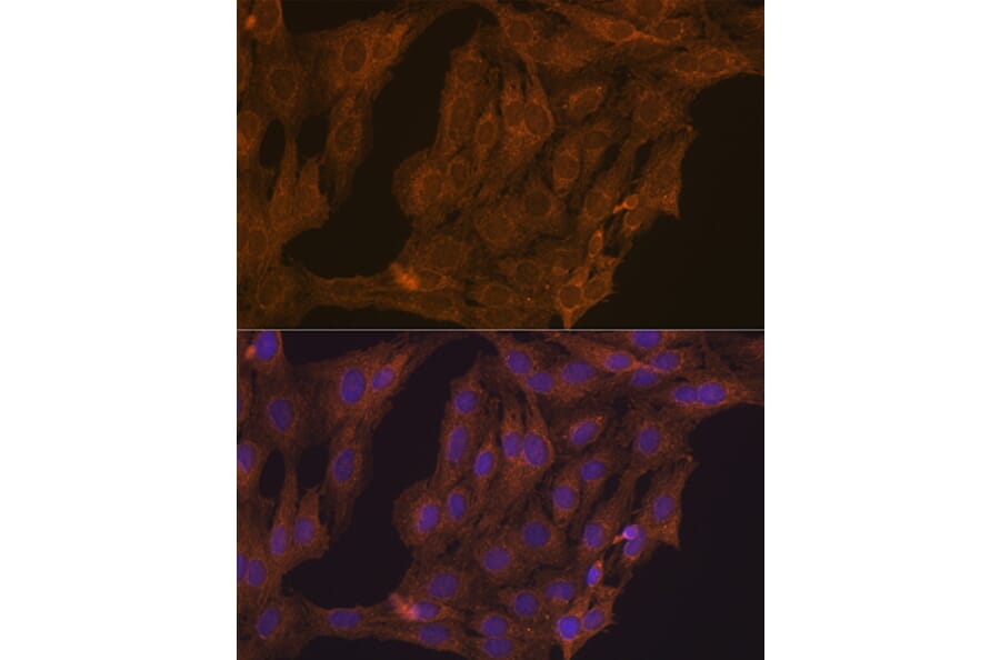 Immunofluorescence - Anti-Retinoic Acid Receptor alpha Antibody (A12622) - Antibodies.com