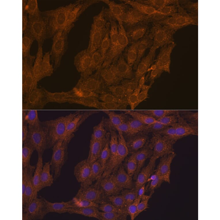 Immunofluorescence - Anti-Retinoic Acid Receptor alpha Antibody (A12622) - Antibodies.com