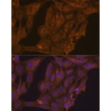 Immunofluorescence - Anti-Retinoic Acid Receptor alpha Antibody (A12622) - Antibodies.com