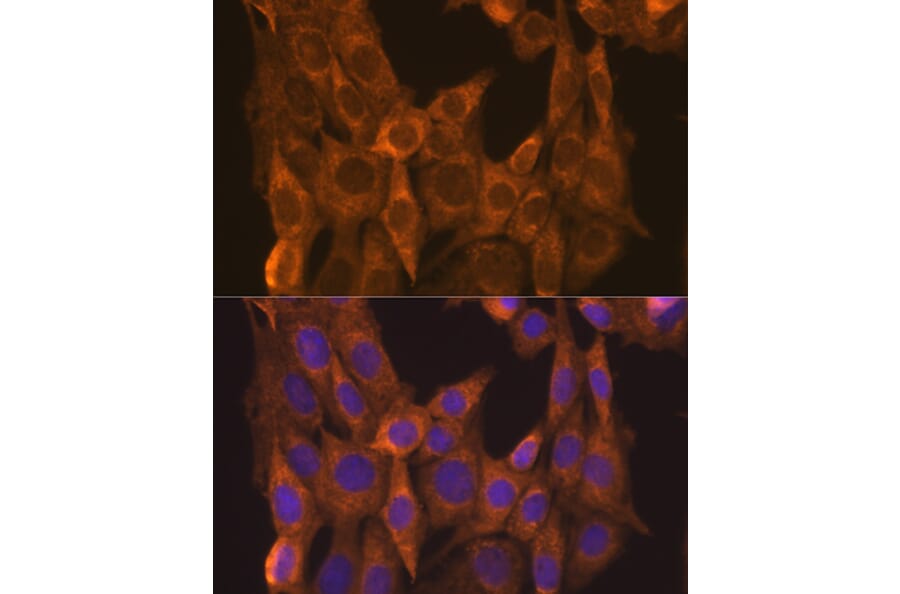 Immunofluorescence - Anti-Retinoic Acid Receptor alpha Antibody (A12622) - Antibodies.com