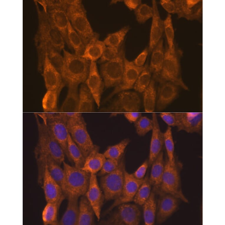 Immunofluorescence - Anti-Retinoic Acid Receptor alpha Antibody (A12622) - Antibodies.com