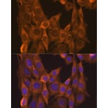 Immunofluorescence - Anti-Retinoic Acid Receptor alpha Antibody (A12622) - Antibodies.com