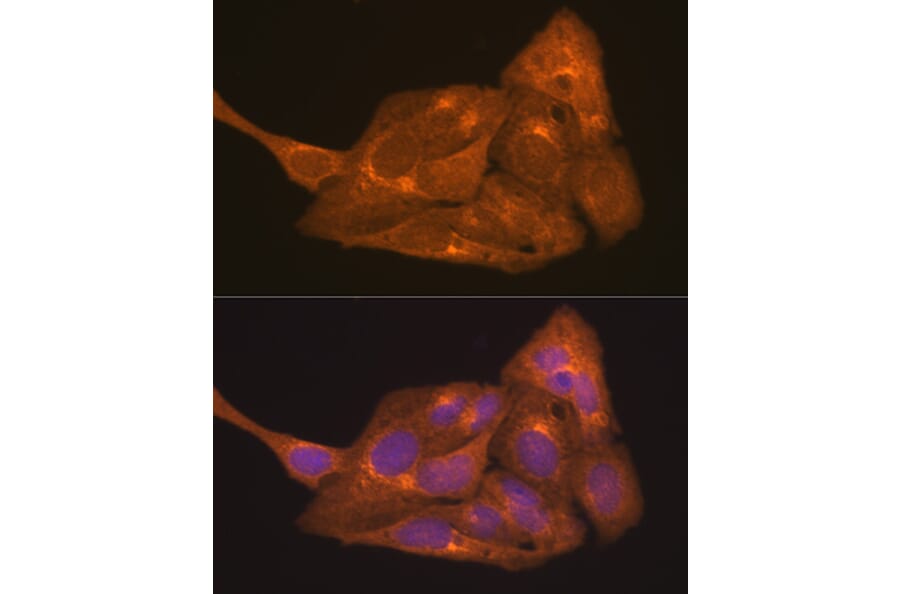Immunofluorescence - Anti-Retinoic Acid Receptor alpha Antibody (A12622) - Antibodies.com