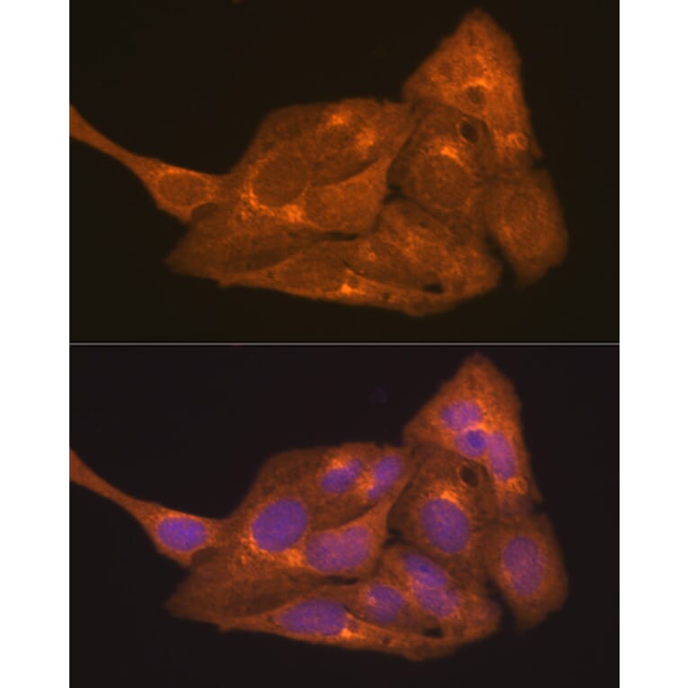 Immunofluorescence - Anti-Retinoic Acid Receptor alpha Antibody (A12622) - Antibodies.com