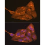 Immunofluorescence - Anti-Retinoic Acid Receptor alpha Antibody (A12622) - Antibodies.com