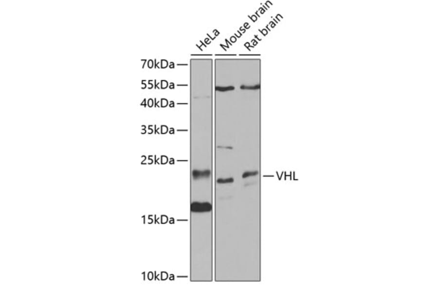 Western Blot - Anti-Von Hippel Lindau/VHL Antibody (A12623) - Antibodies.com