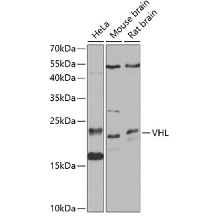 Western Blot - Anti-Von Hippel Lindau/VHL Antibody (A12623) - Antibodies.com