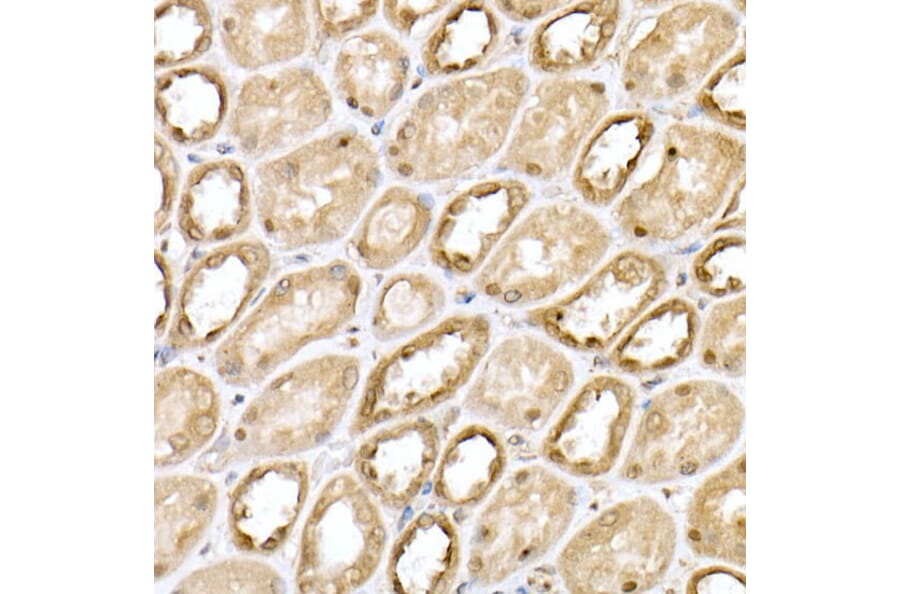 Immunohistochemistry - Anti-Von Hippel Lindau/VHL Antibody (A12623) - Antibodies.com